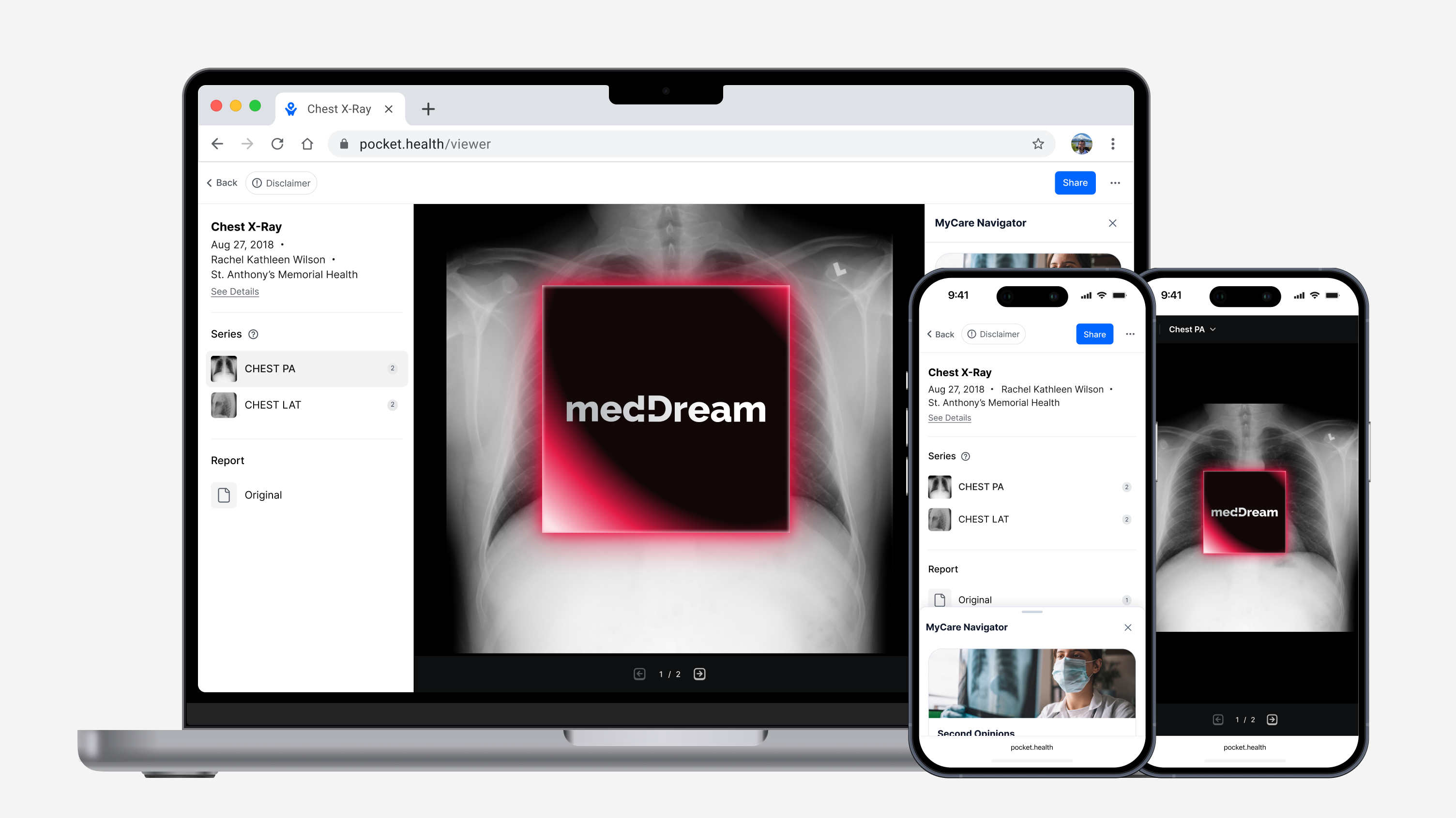 Lady on her phone with PocketHealth patient viewer in the background